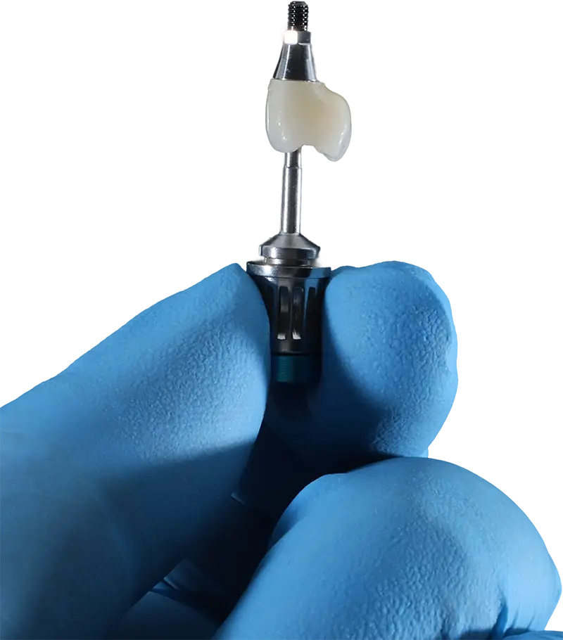implant-supported crown