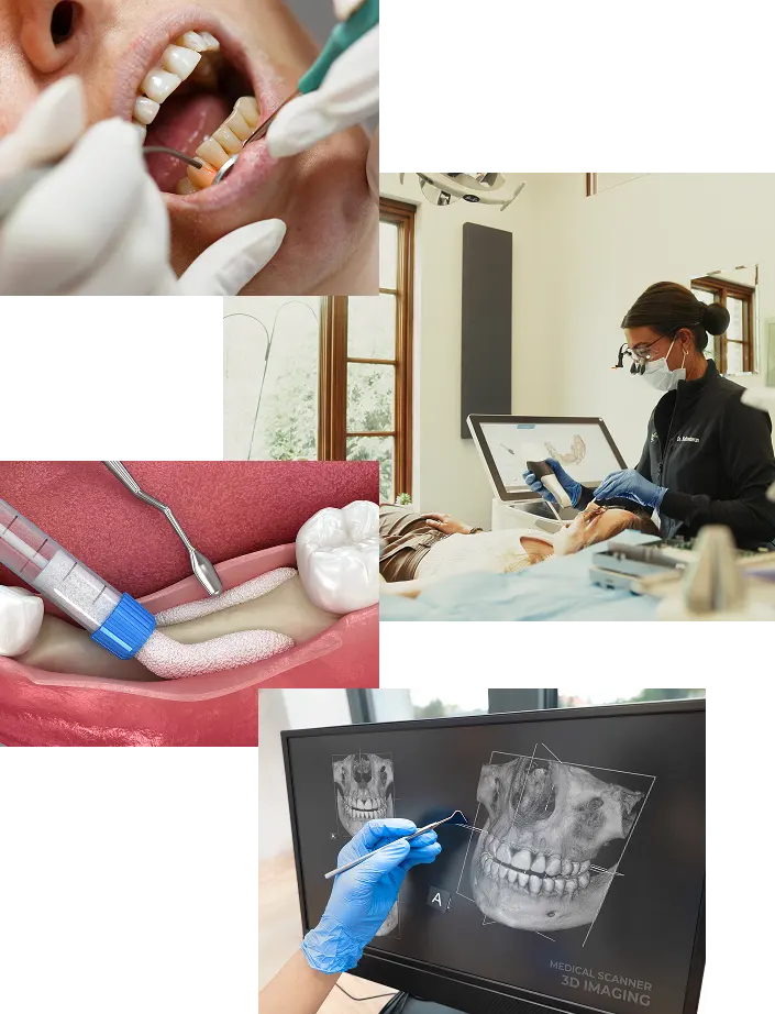 Collage of dental images showing a dental exam, a dentist using a 3D scanner, a bone graft procedure model, and a 3D skull X-ray on a monitor