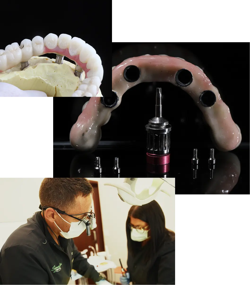 All-on-4 Dental Implants