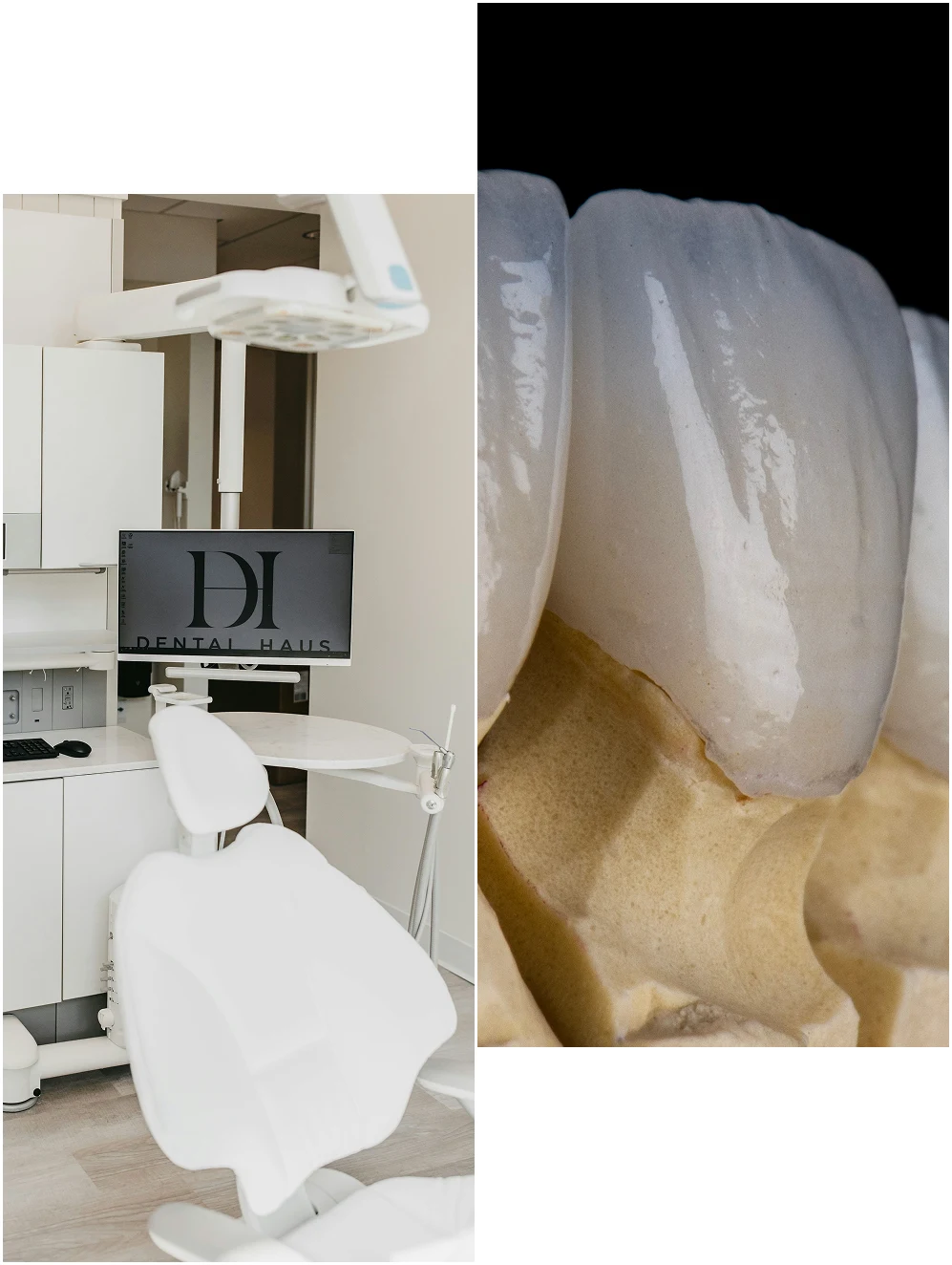 Collage of dental office and tooth model