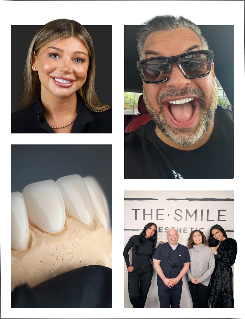collage of Dr. Goldstein and his veneer patients