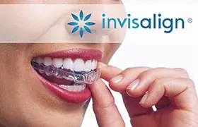 Invisalign
