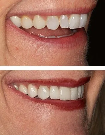 Smile design results