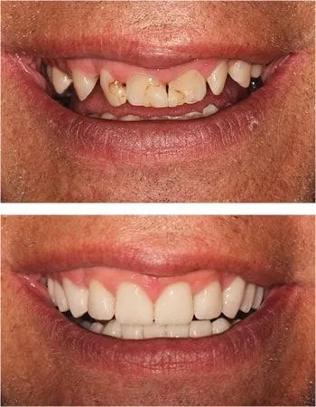 Smile design results