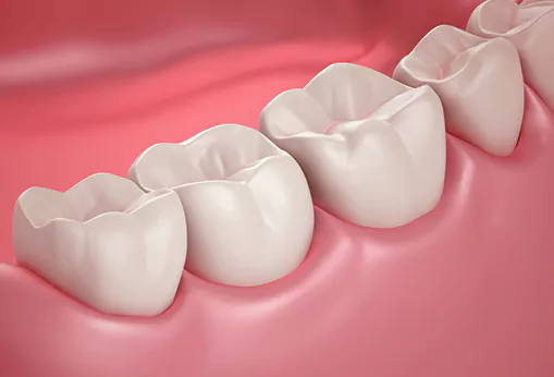 third molar image