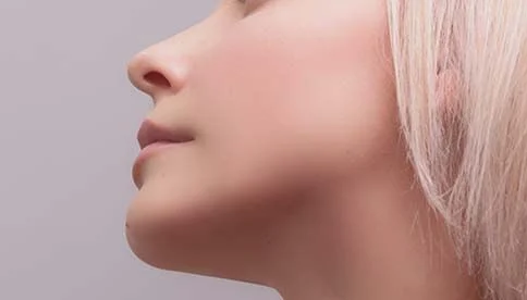 young woman's jaw