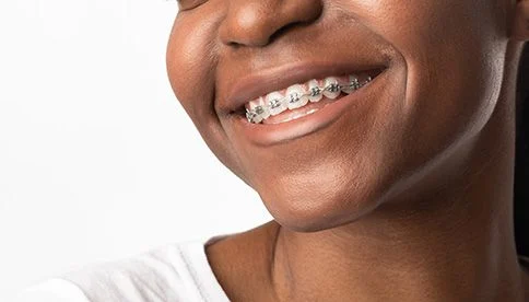young woman with metal braces and nice smile