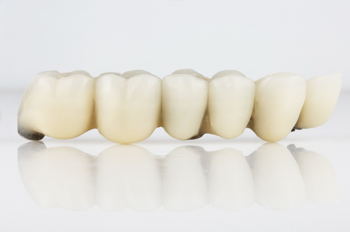 Model Dental Bridge