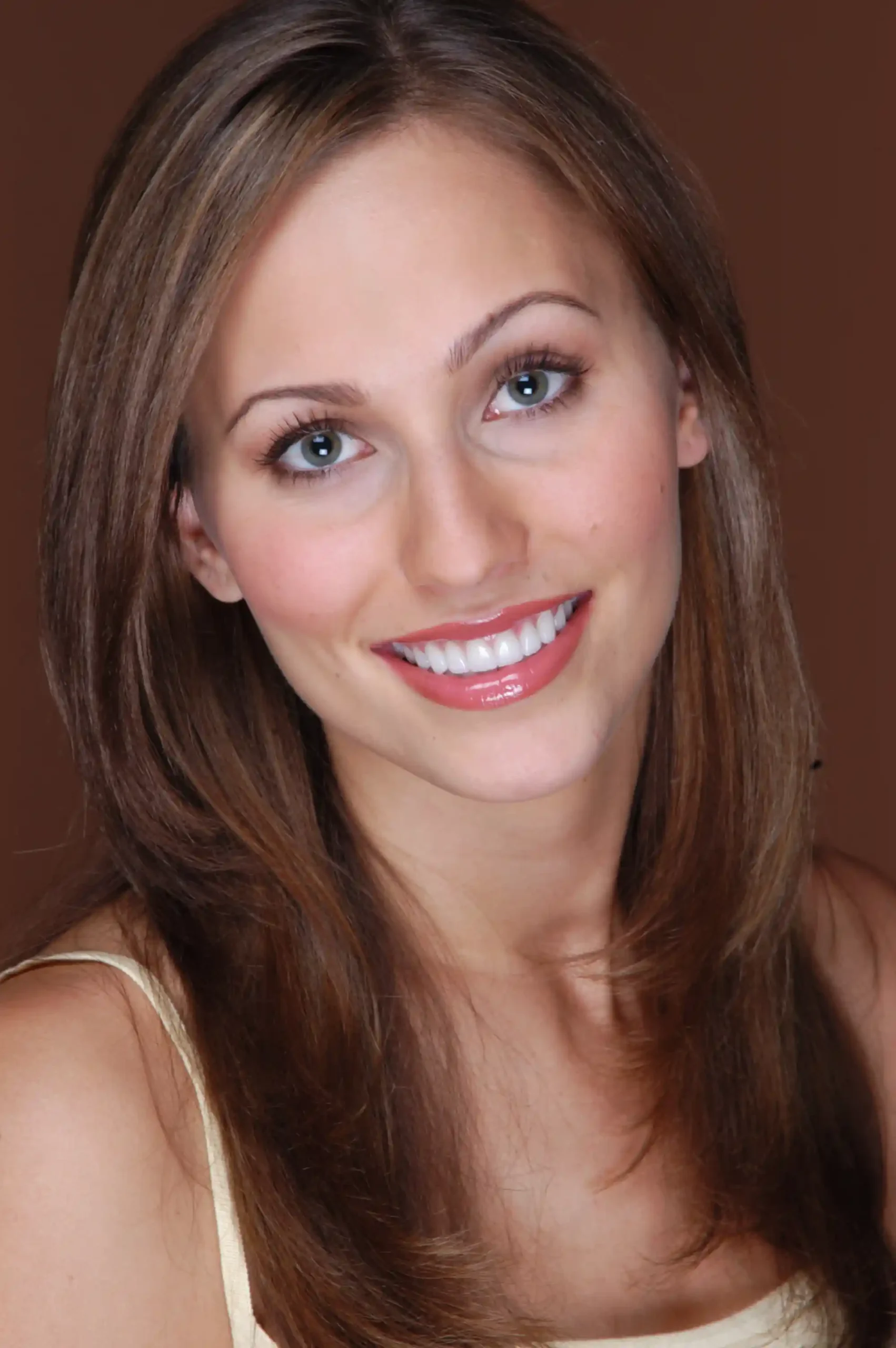 woman with no prep veneers