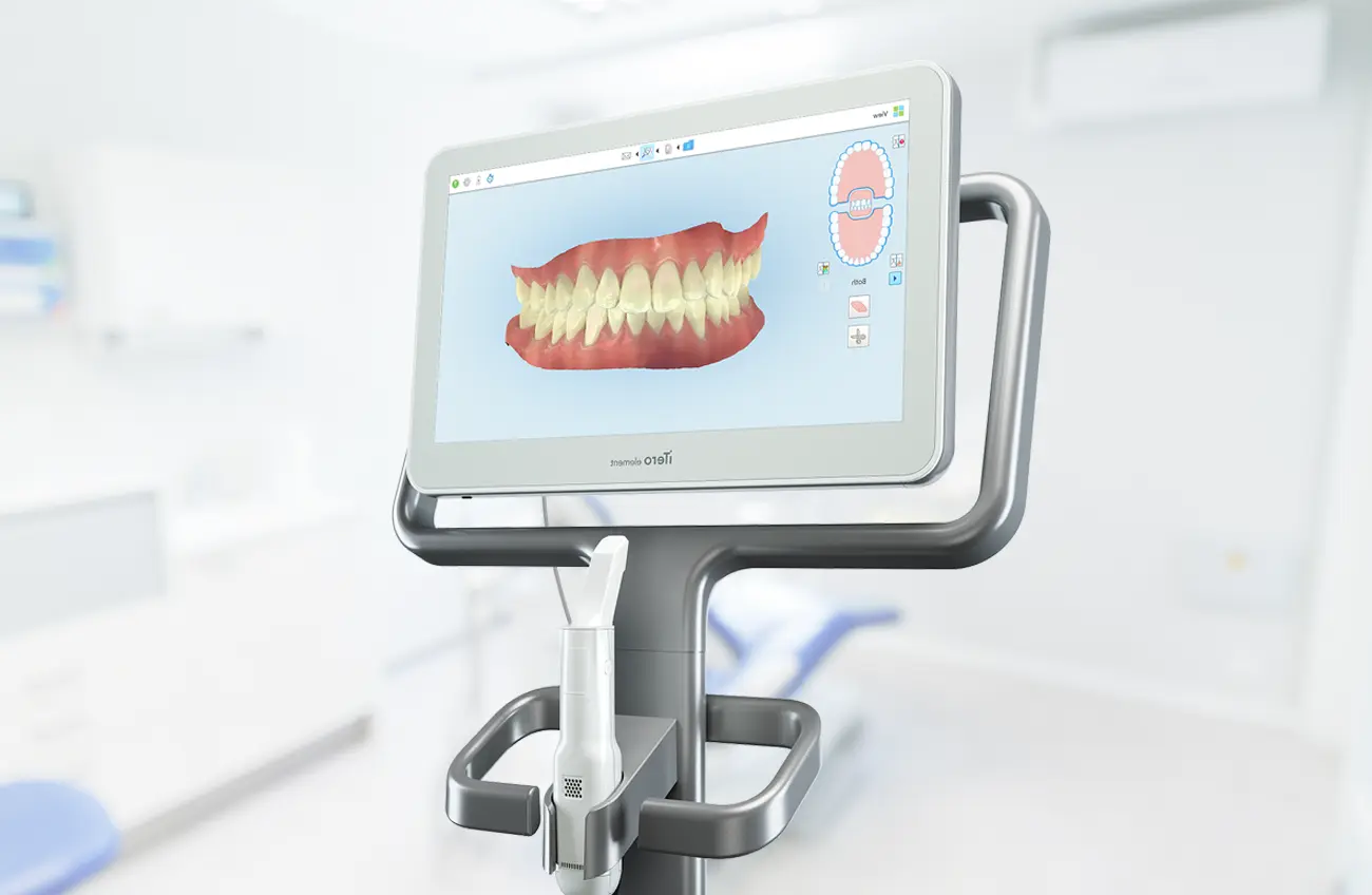 iTero Scanner
