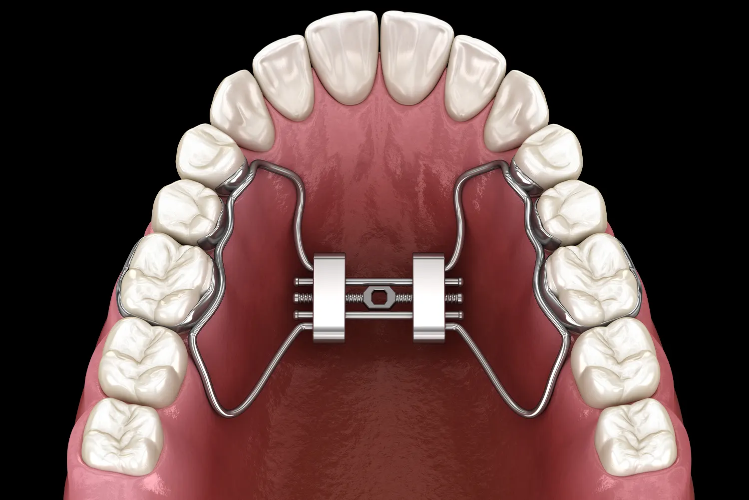 digital rendering of expander